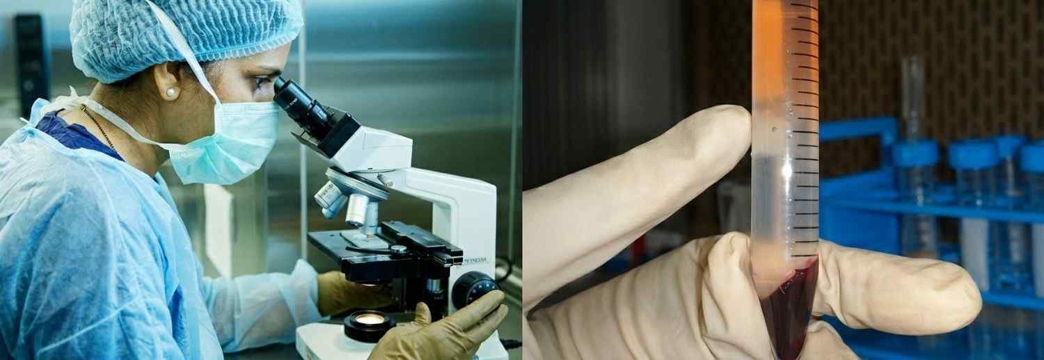 Separation of Cells