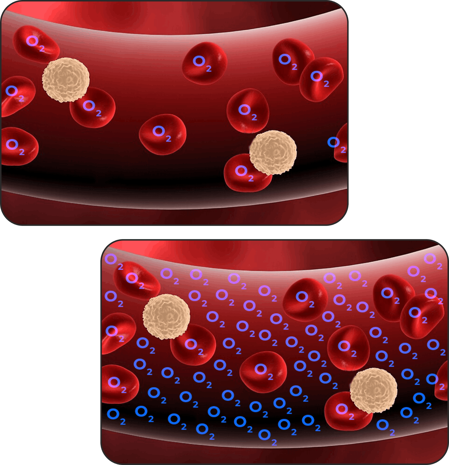 How Hyperbaric Oxygen Therapy works